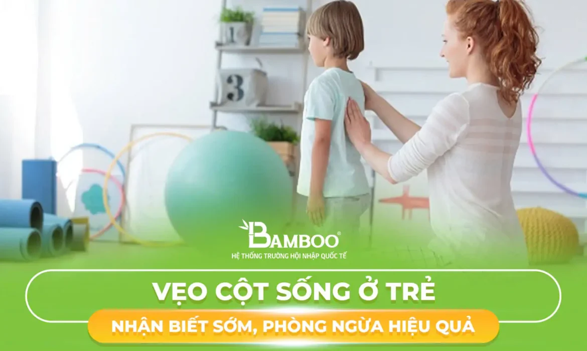 Vẹo Cột Sống Ở Trẻ – 5 Dấu Hiệu Nhận Biết Sớm, Phòng Ngừa Hiệu Quả